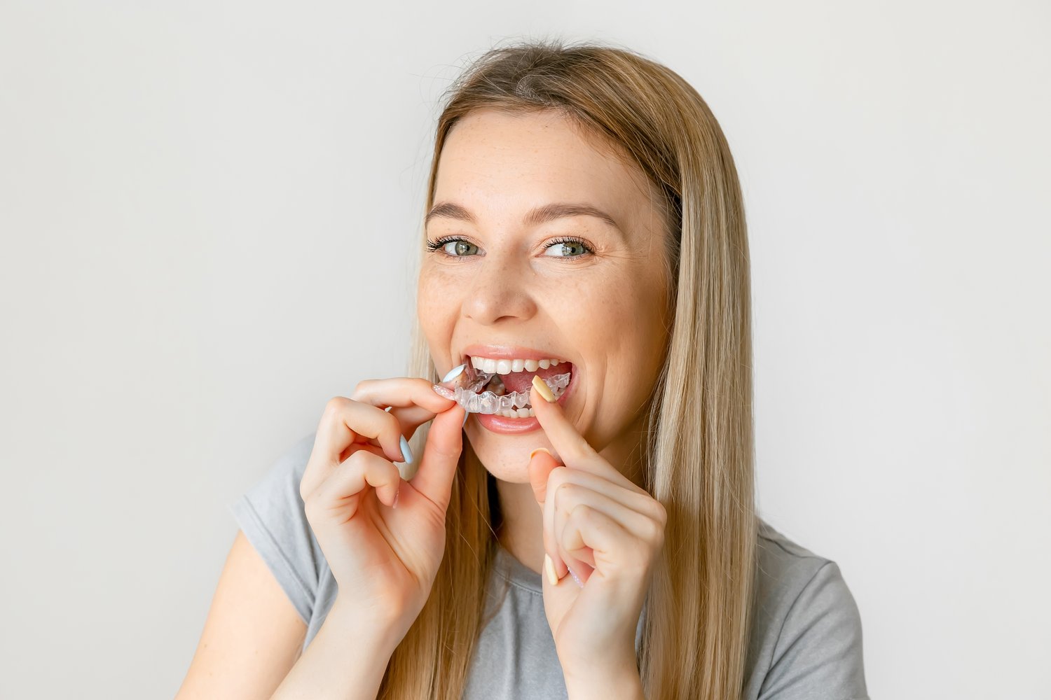 A patient placing a clear aligner tray into her mouth
