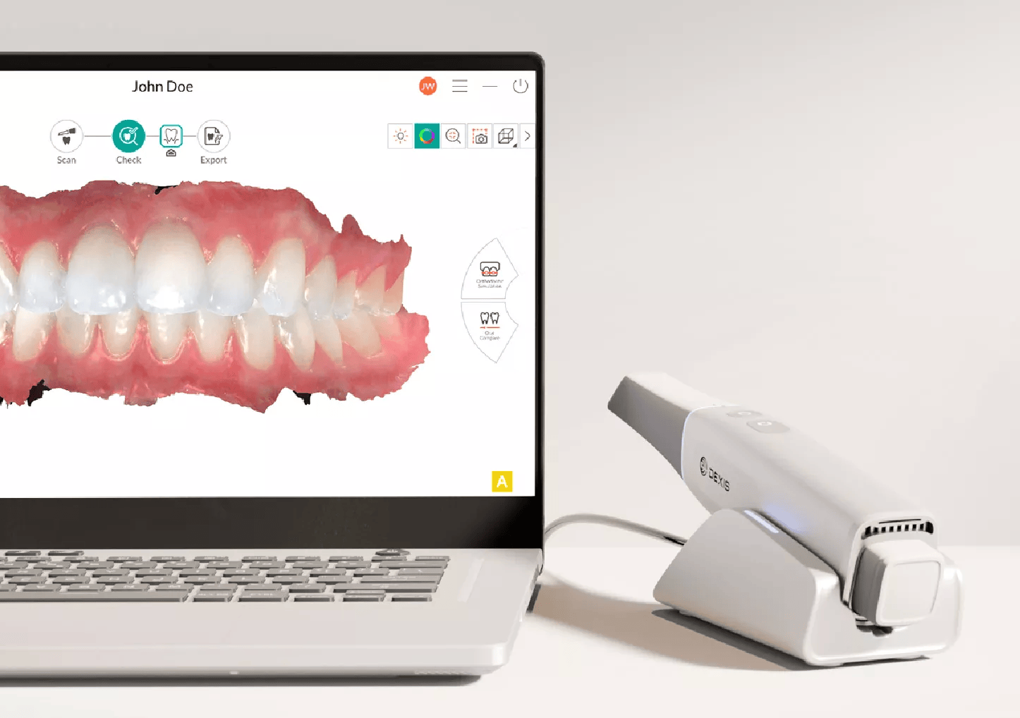 DEXIS IMPREVO digital impression scanner